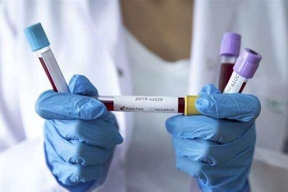 Два подозрения на коронавирус в Северодонецке не подтвердились